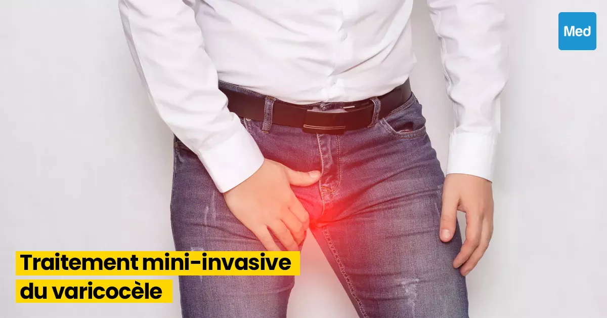 Le Traitement Mini-Invasif du Varicocèle : Une Révolution pour la Santé Masculine